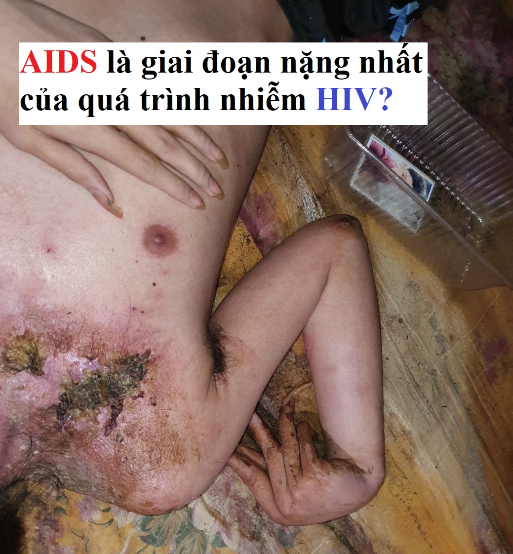 Vì sao xét nghiệm nước bọt giúp phát hiện nhiễm HIV?